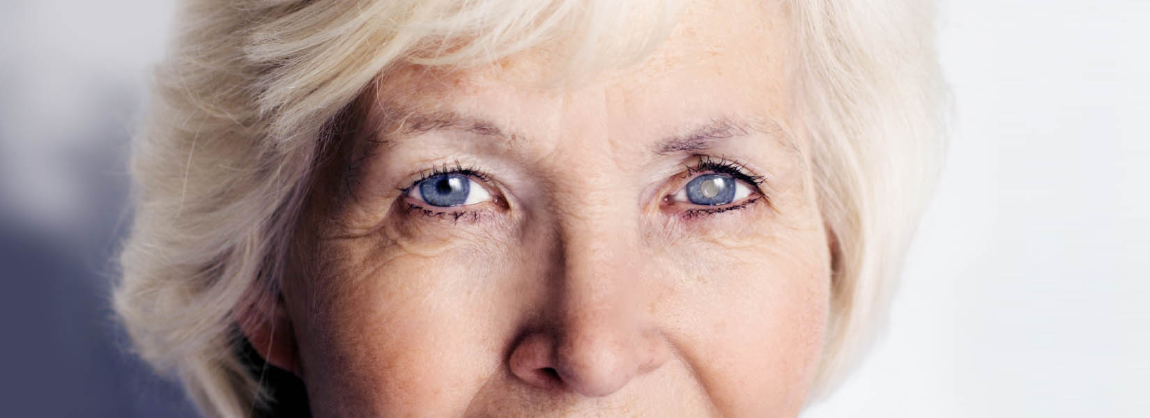 Cataract Surgery in Centerville